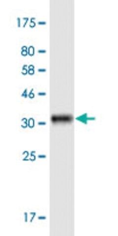 Monoclonal Anti-KCNK1 antibody produced in mouse