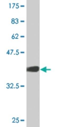 Monoclonal Anti-KNG1, (C-terminal) antibody produced in mouse