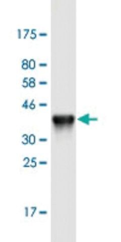 Monoclonal Anti-KRT24 antibody produced in mouse