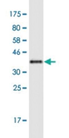 Monoclonal Anti-KIF17 antibody produced in mouse