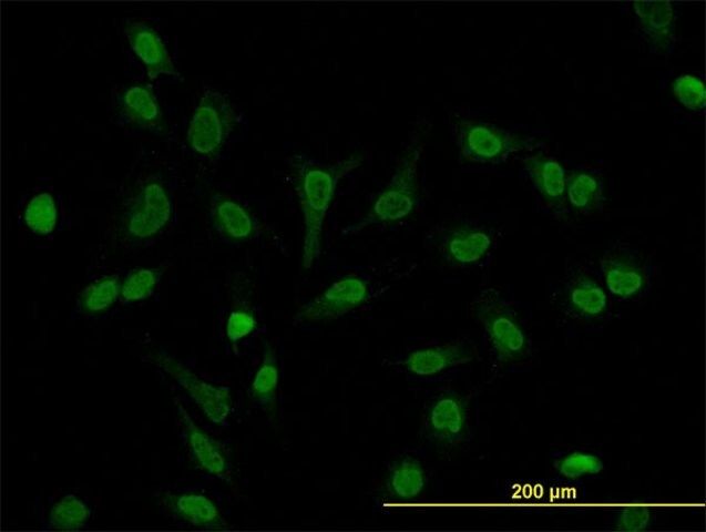 Monoclonal Anti-LEF1 antibody produced in mouse