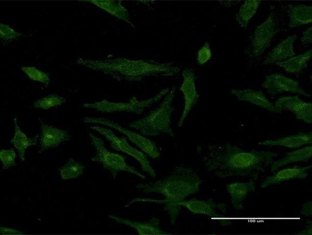 Monoclonal Anti-MCFD2 antibody produced in mouse