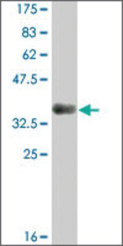 Monoclonal Anti-MRAP, (C-terminal) antibody produced in mouse