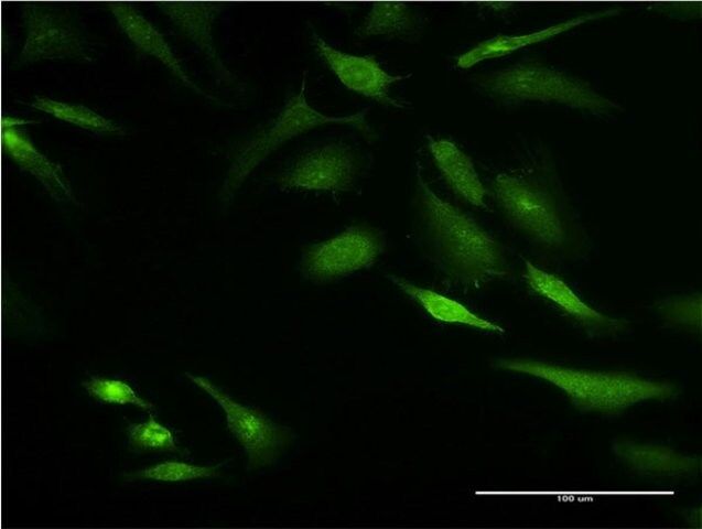 Monoclonal Anti-KRT8 antibody produced in mouse