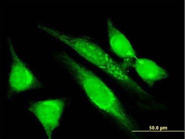 Monoclonal Anti-MGRN1 antibody produced in mouse