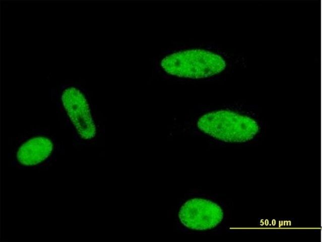 Monoclonal Anti-MLLT1 antibody produced in mouse