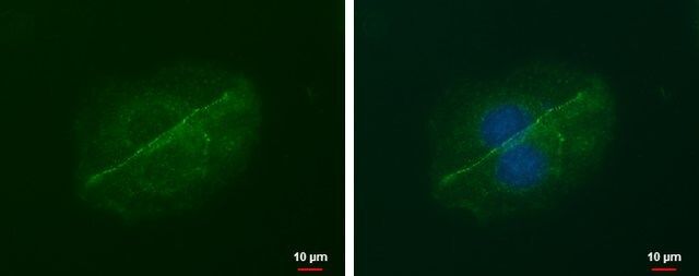 Monoclonal Anti-LIN7A antibody produced in mouse