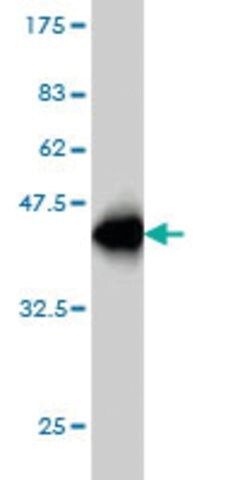 Monoclonal Anti-MEFV antibody produced in mouse