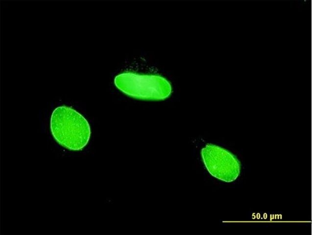 Monoclonal Anti-MLLT6 antibody produced in mouse