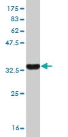 Monoclonal Anti-MCM8 antibody produced in mouse