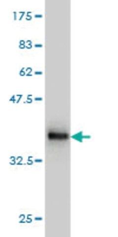 Monoclonal Anti-NADSYN1 antibody produced in mouse