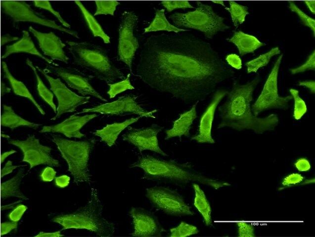 Monoclonal Anti-RNF2 antibody produced in mouse