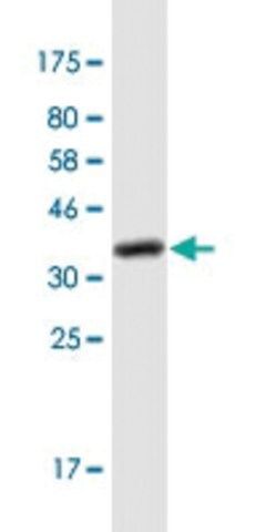 Monoclonal Anti-RPGRIP1 antibody produced in mouse