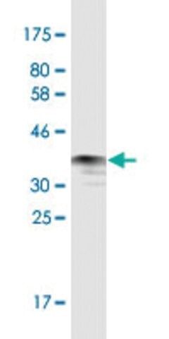 Monoclonal Anti-ROCK1 antibody produced in mouse