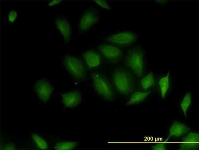 Monoclonal Anti-RP6-213H19.1 antibody produced in mouse