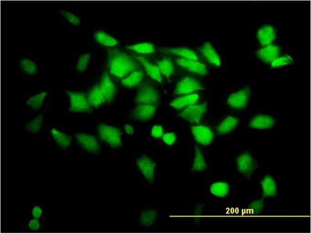 Monoclonal Anti-SGTA antibody produced in mouse