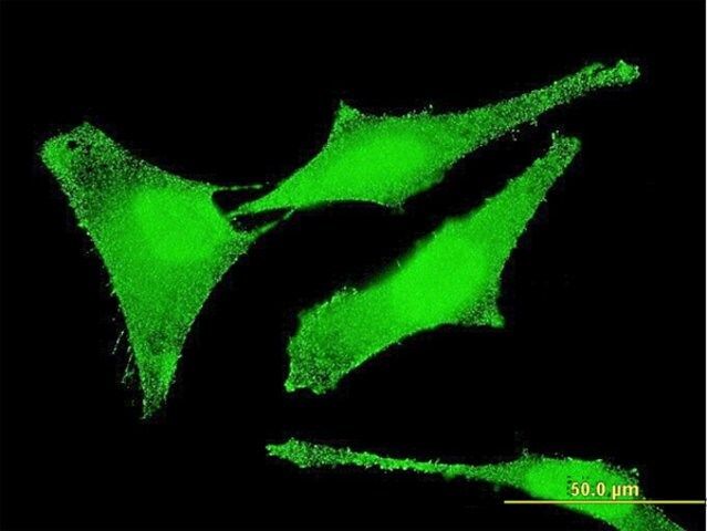 Monoclonal Anti-SET antibody produced in mouse