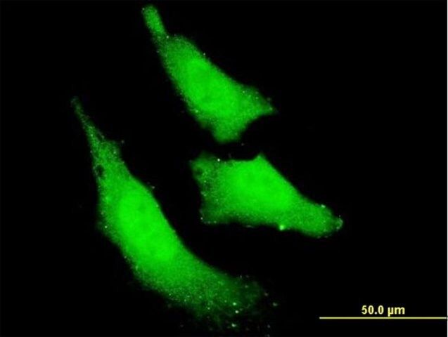 Monoclonal Anti-RNF111 antibody produced in mouse