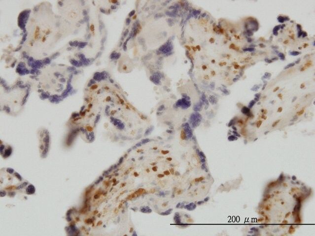 Monoclonal Anti-EXOSC8 antibody produced in mouse