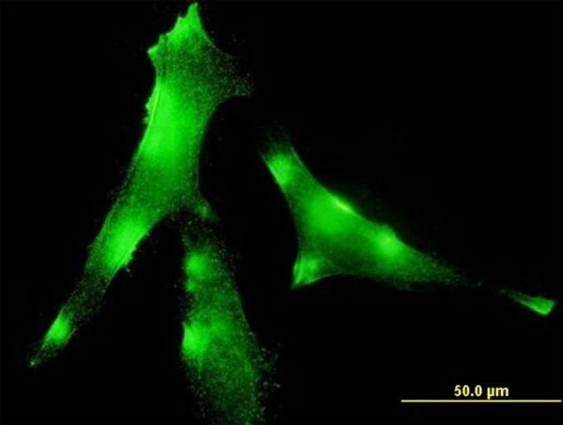 Monoclonal Anti-EVL antibody produced in mouse