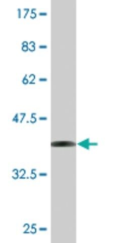 Monoclonal Anti-EXOSC10, (N-terminal) antibody produced in mouse