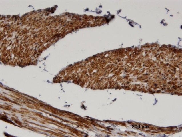 Monoclonal Anti-FADS1, (N-terminal) antibody produced in mouse