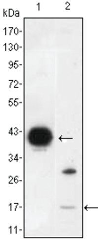 Monoclonal Anti-FABP2 antibody produced in mouse