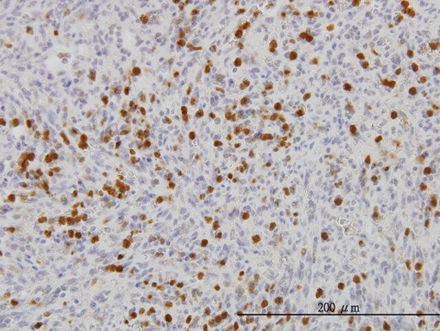 Monoclonal Anti-FGR, (N-terminal) antibody produced in mouse