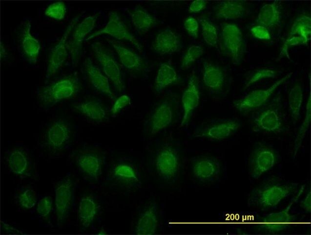 Monoclonal Anti-FH antibody produced in mouse