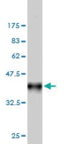 Monoclonal Anti-FHIT antibody produced in mouse