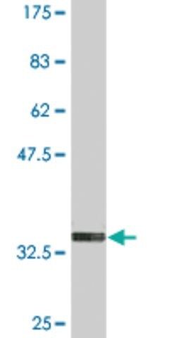 Monoclonal Anti-FOLR2 antibody produced in mouse