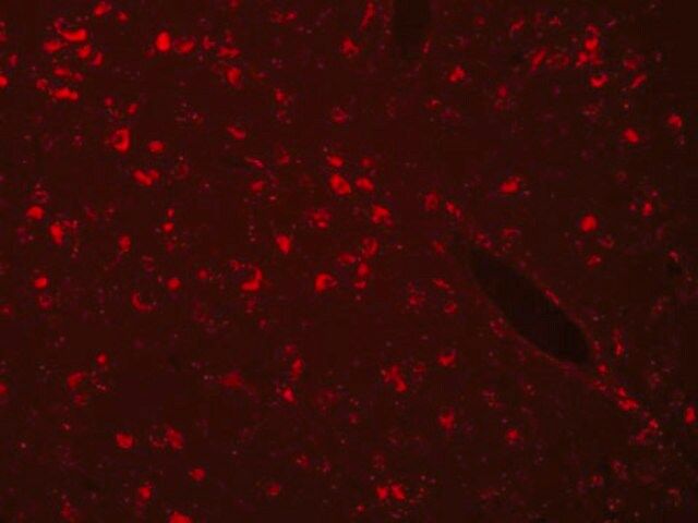 Autofluorescence Eliminator Reagent