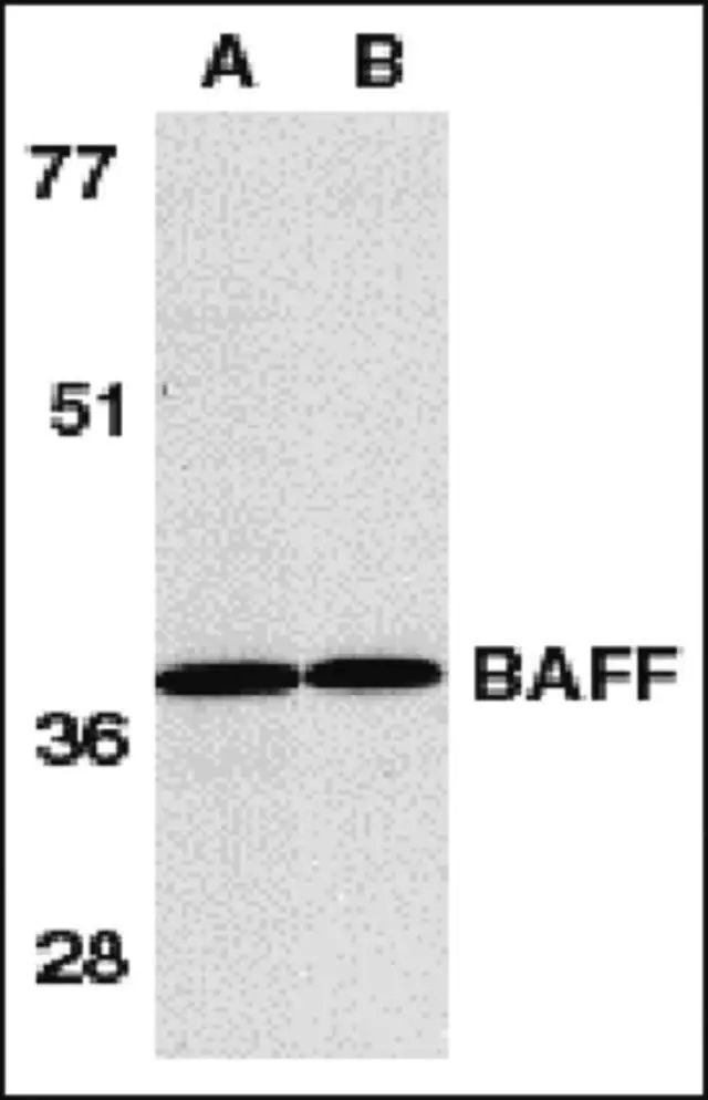 Anti-BAFF Antibody, CT