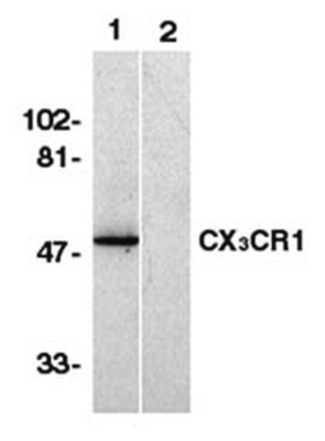 Anti-C-X-X-X-C Chemokine Receptor 1 Antibody, NT