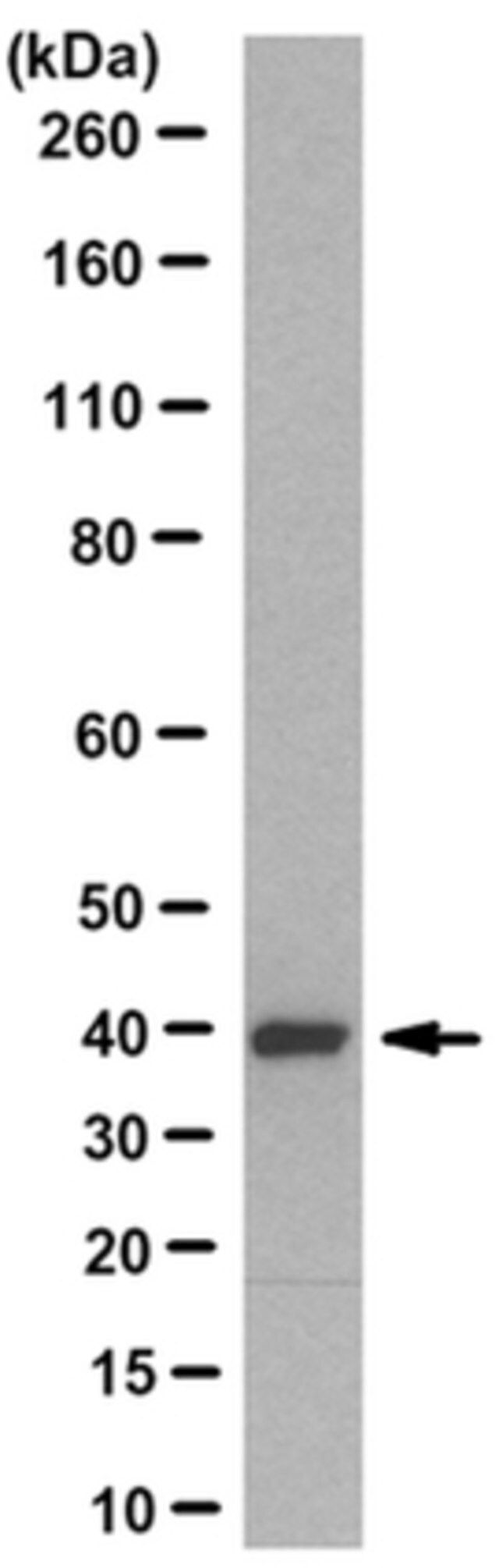 Anti-GNAT1 Antibody, clone 11A8.1