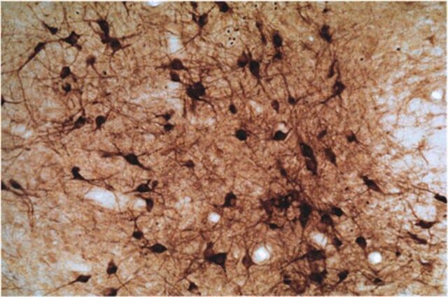 Anti-Nitric Oxide Synthase I Antibody