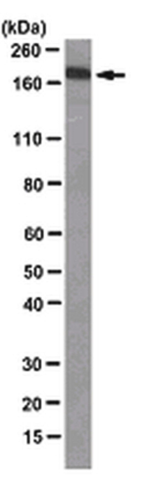 Anti-Werners syndrome helicase (WRN) Antibody, clone 20A11.1