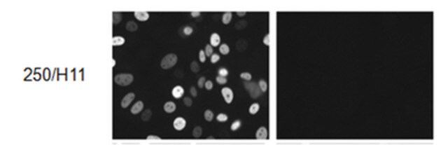 Anti-Progesterone Receptor B Antibody, clone 250/H11