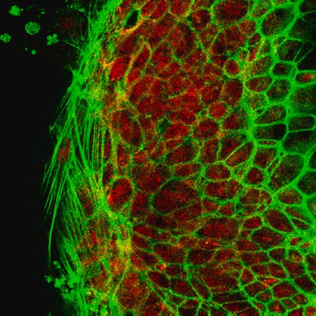 Anti-Pumilio-2 (PUM2) Antibody