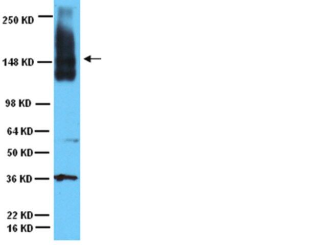 Anti-Neural Cell Adhesion Molecule Antibody