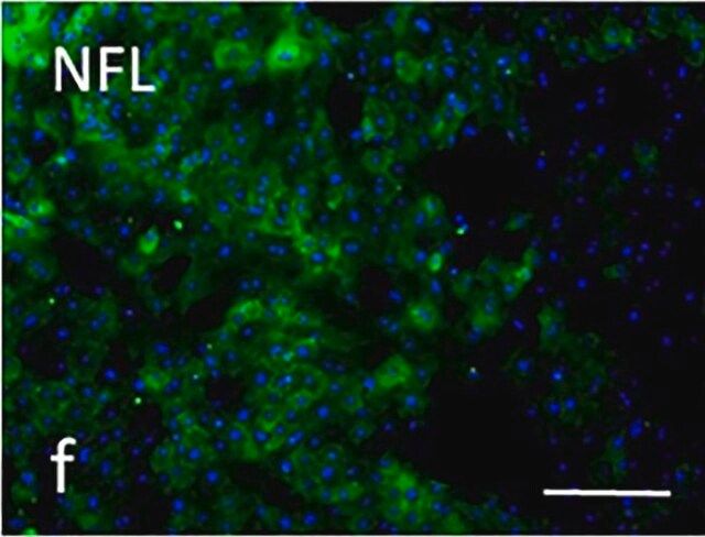 Anti-Neurofilament L Antibody