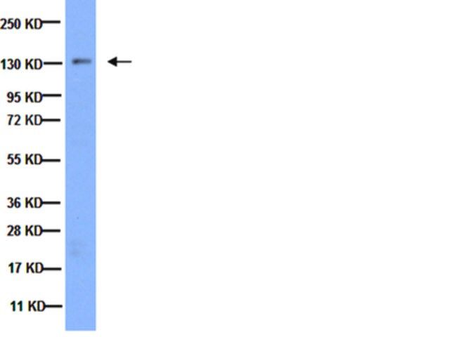 Anti-Integrin 3 Antibody