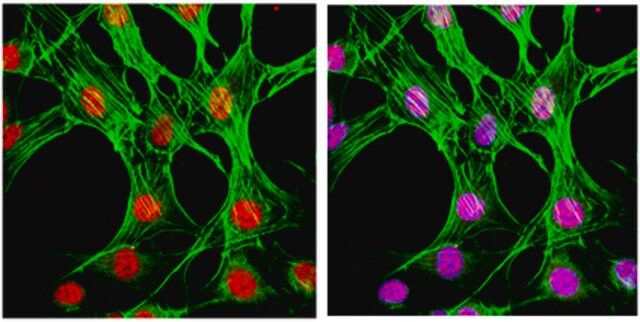 Anti-phospho-p38 (Thr180/Tyr182) Antibody, clone 6E5.2