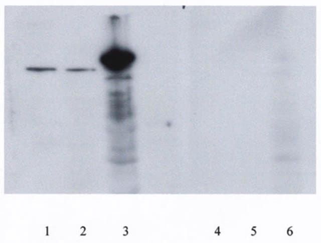 Anti-PGC-1 Antibody