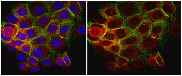 Anti-phospho-p70 S6 Kinase (Thr389) Antibody, clone 10G7.1