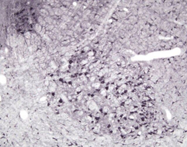 Anti-Nitric Oxide Synthase I Antibody