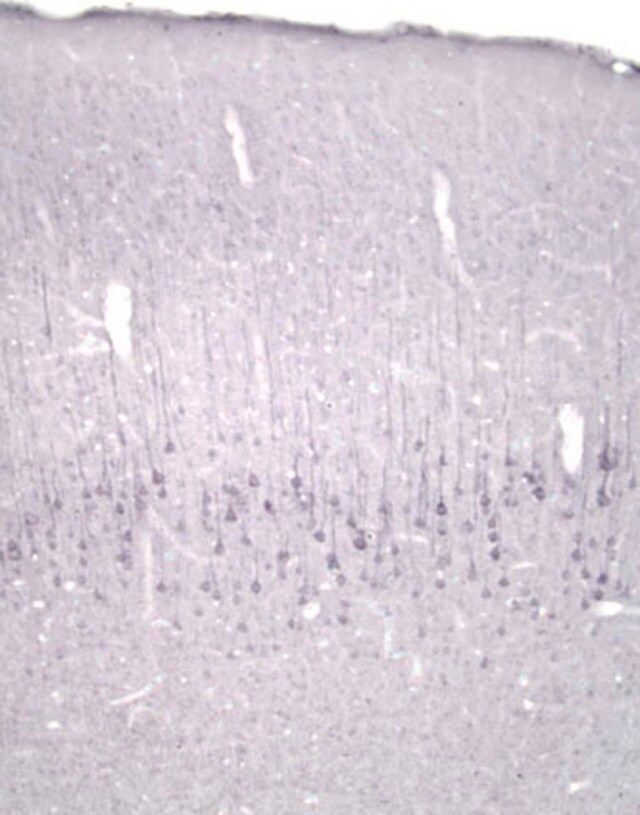 Anti-Neurotrophin 4/5 Antibody