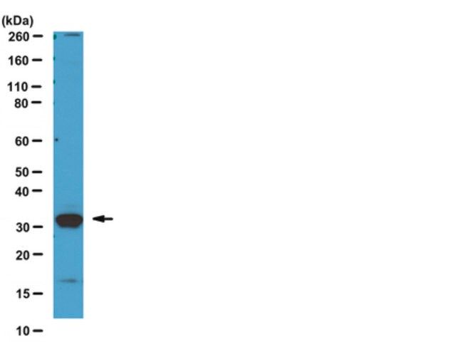 Anti-Kallikrein-3 (KLK3) (CT) Antibody