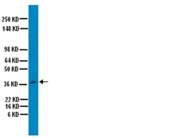 Anti-Osteopontin Antibody