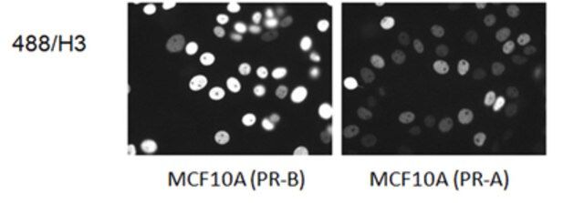 Anti-Progesterone Receptor A/B Antibody, clone 488/H3